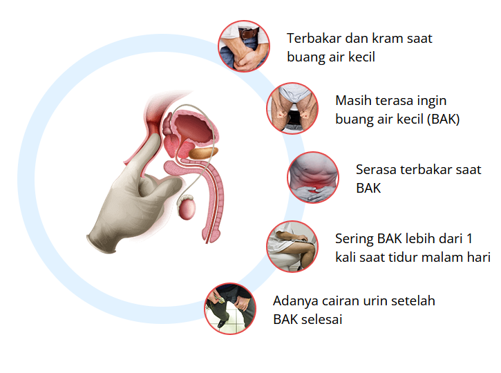 Prostate Anatomy